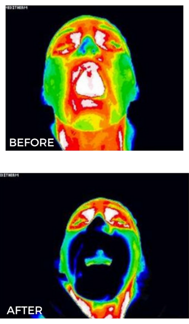 Thermal images comparing before and after device use.